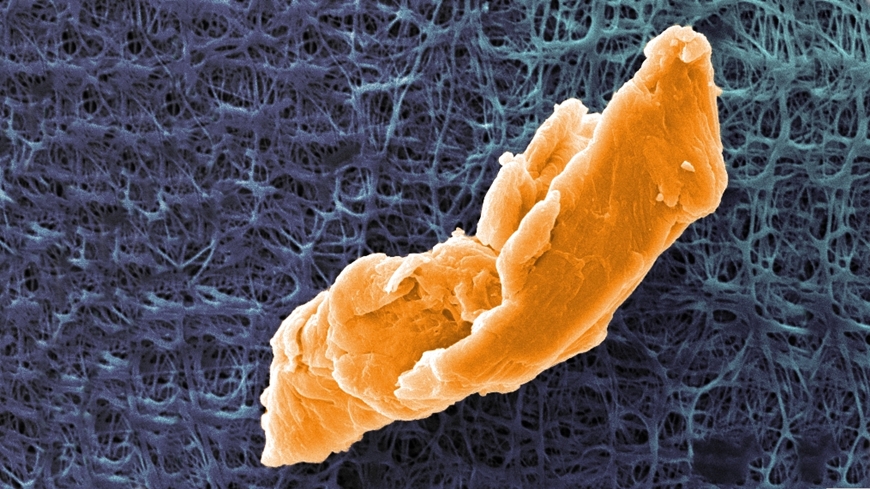 Microplastic particle about 40 µm in size under the scanning electron microscope (colored). Image: Martin Pivokonský / The Czech Academy of Sciences / Empa