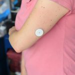 Wearable glucose sensor on arm